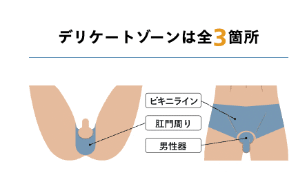 レジーナクリニックオムVIOの施術箇所