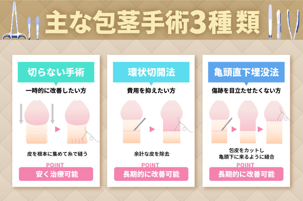 主な包茎手術3種類に関する解説画像