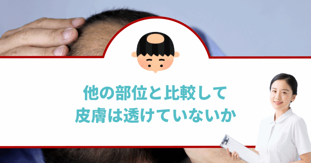 他の部位と比較して皮膚は透けていないか