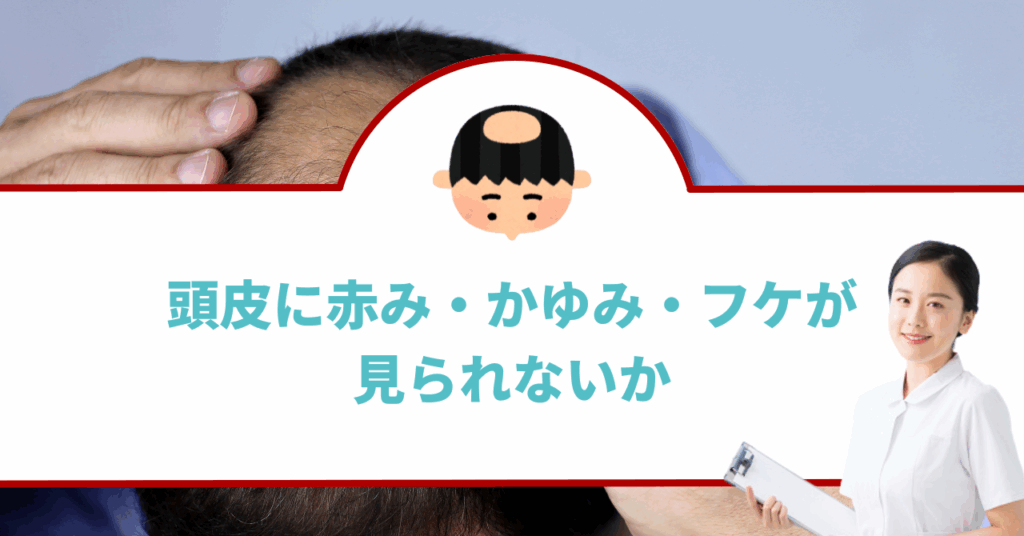 頭皮に赤み・かゆみ・フケが見られないか