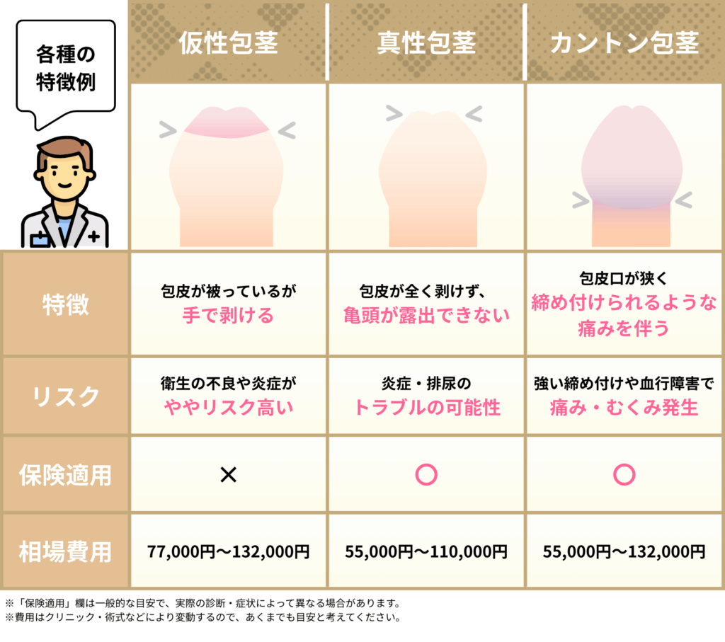 包茎の種類3種類の特徴や相場費用を比較したイラスト画像