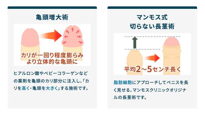 マンモスクリニックの亀頭増大に関するイメージ画像