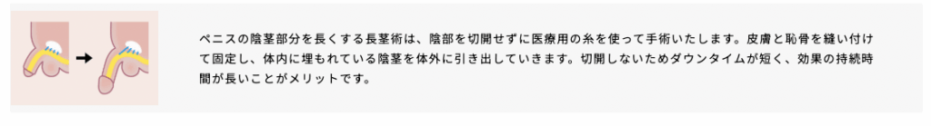 アトムクリニックの長茎術の詳細に関するイラスト画像