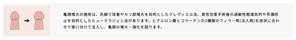 アトムクリニックの増大術の詳細に関するイラスト画像
