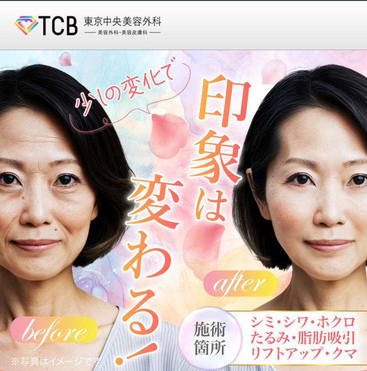 TCB東京中央美容外科のワキガ治療に関する画像