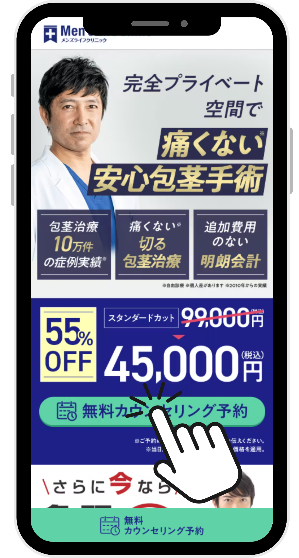 メンズライフクリニックの包茎手術に関するイラスト画像