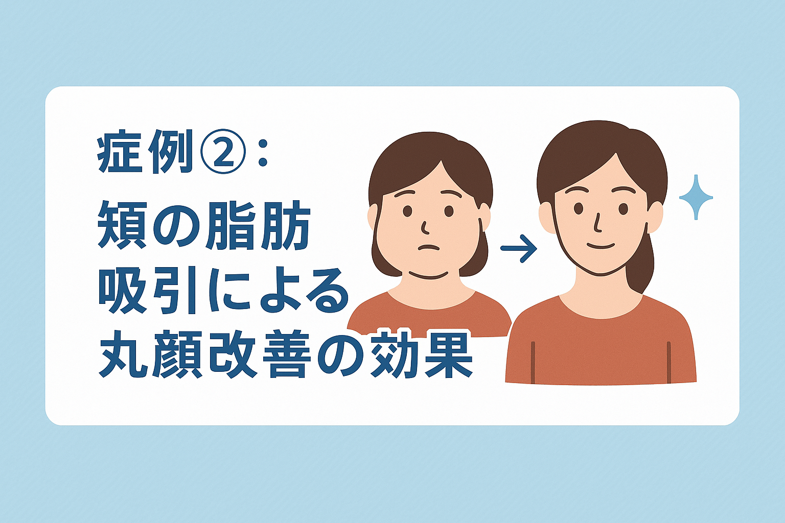 症例②:頬の脂肪吸引による丸顔改善の効果