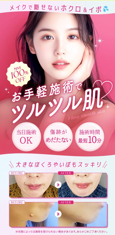 TCB東京中央美容外科のほくろ除去の施術イメージ