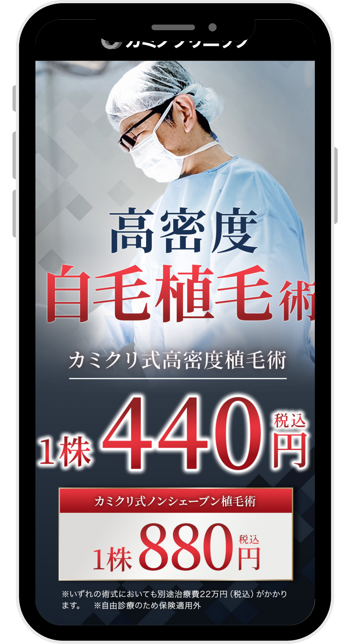 カミノクリニックの自毛植毛に関するイラスト画像