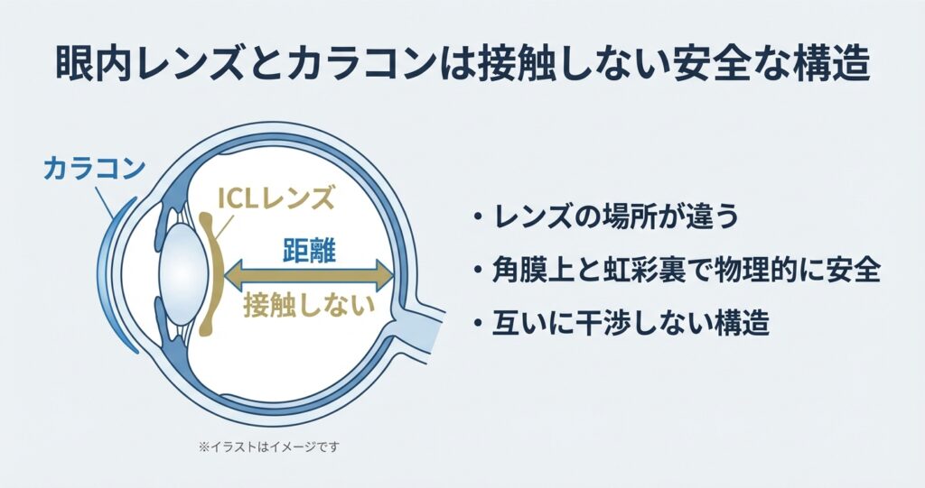 眼内レンズとカラコンは接触しない安全な構造