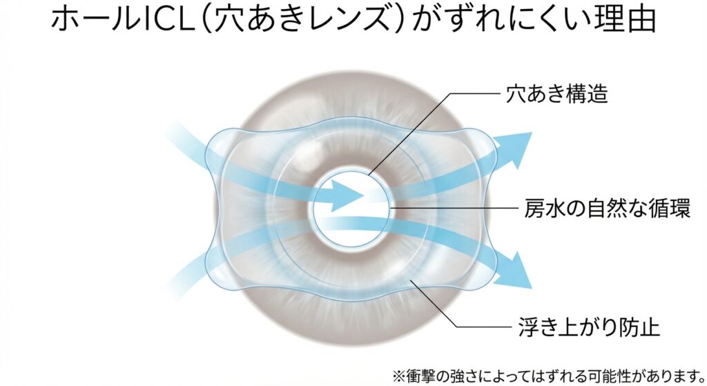 ホールICLがずれにくい理由