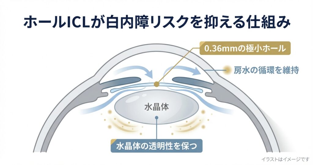 ホールICLが白内障リスクを抑える仕組み